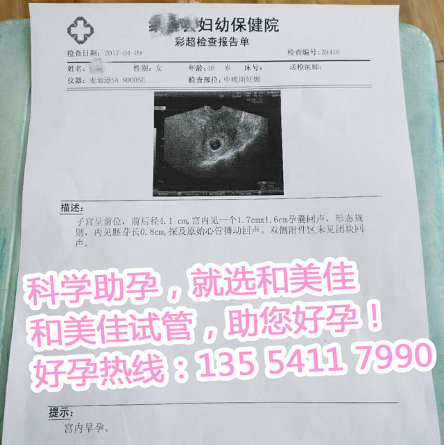 高龄求子,第三试管婴儿顺利怀上健康男孩