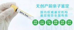 试管婴儿受年龄影响吗